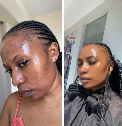 KORMESIC
